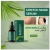 Markaway Advanced Stretch Mark Serum – Clinic-Tested Formula for Prevention & Fading | Retinol, Hydroquinone, & AHA/BHA-Free